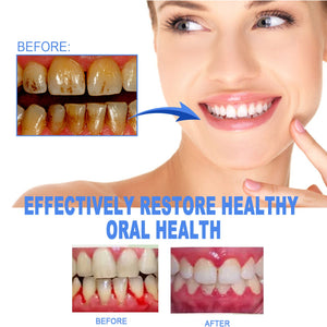 EELHOE Dental Repair Gel, Repair Gums Cleaning Dental Stains And Tartar Oral Care Gel Winteres