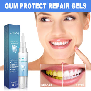 EELHOE Dental Repair Gel, Repair Gums Cleaning Dental Stains And Tartar Oral Care Gel Winteres